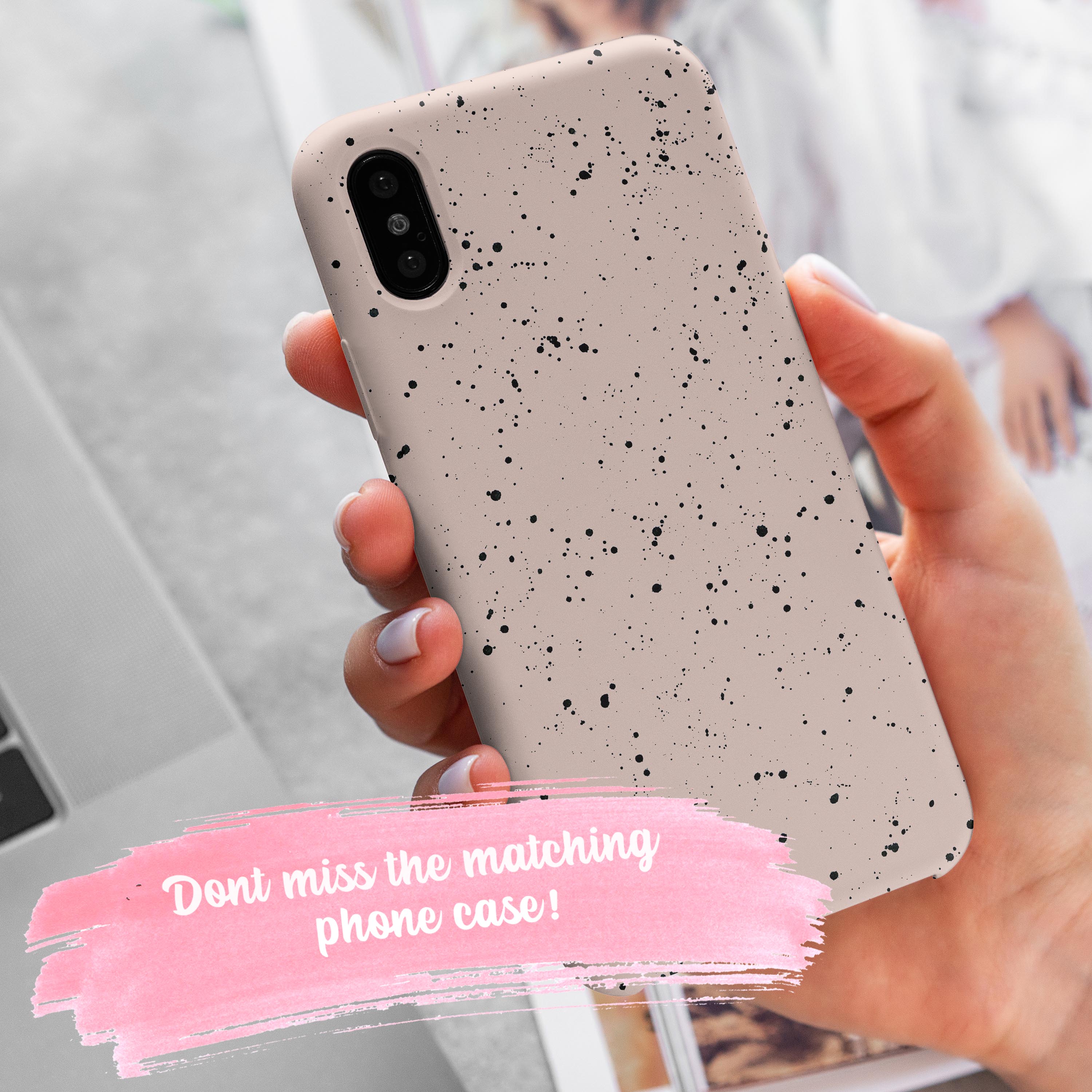 Specks Apple Watch Strap Apple Watch Straps - Casetful