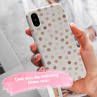 Puntos Apple Watch Strap Apple Watch Straps - Casetful